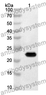 Anti-Human ATP6V0A1 Polyclonal Antibody