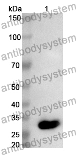 Anti-Human BCCIP Polyclonal Antibody