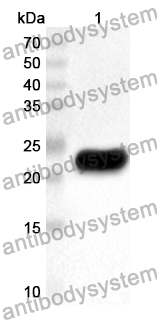 Anti-Human COMMD5 Polyclonal Antibody