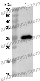 Anti-Human DDA1 Polyclonal Antibody