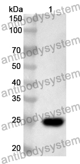 Anti-Human DPF2 Polyclonal Antibody