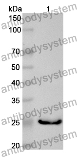 Anti-Human FAF1 Polyclonal Antibody