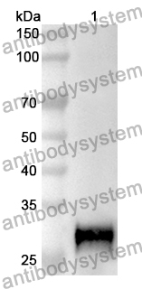 Anti-Human FLCN Polyclonal Antibody