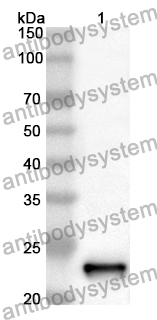 Anti-Human MACROH2A2 Polyclonal Antibody