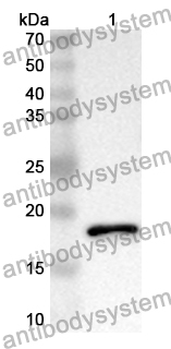 Anti-Human HECTD1 Polyclonal Antibody