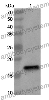 Anti-Human MSRB2 Polyclonal Antibody