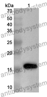 Anti-Human NFKBIZ Polyclonal Antibody