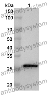 Anti-Human TESC Polyclonal Antibody