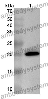 Anti-Human TEX10 Polyclonal Antibody