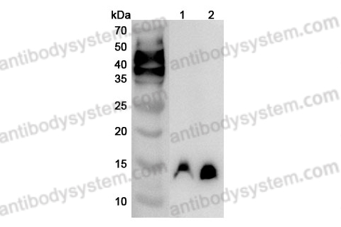 Anti-Human TIMM13 Polyclonal Antibody