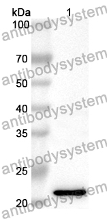 Anti-Human TRIM69 Polyclonal Antibody