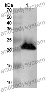 Anti-Human TRIM9 Polyclonal Antibody