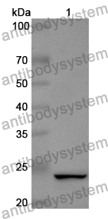 Anti-Human ULBP1 Polyclonal Antibody