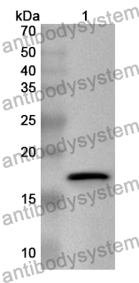 Anti-Human USP20 Polyclonal Antibody