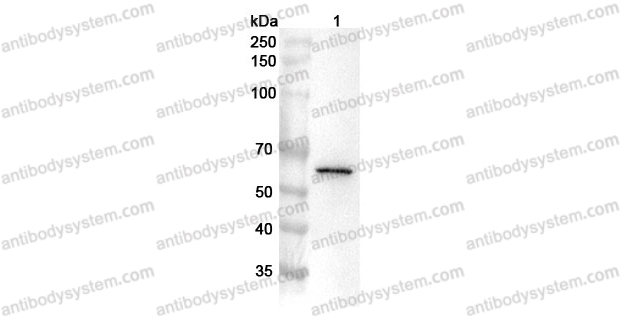 Anti-Human USP22 Polyclonal Antibody