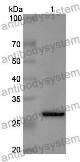 Anti-Human XRN2 Polyclonal Antibody