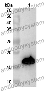 Anti-Human ZBTB18 Polyclonal Antibody