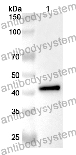 Anti-Human ACSS2 Polyclonal Antibody