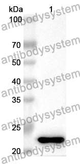 Anti-Human GADD45GIP1 Polyclonal Antibody