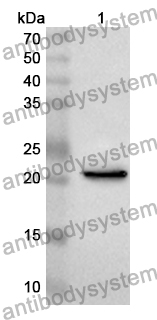 Anti-Human RAB3IP Polyclonal Antibody