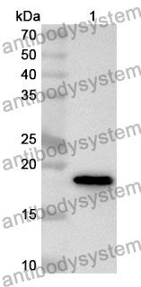 Anti-Human NXF1 Polyclonal Antibody