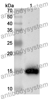 Anti-Human KCTD12 Polyclonal Antibody