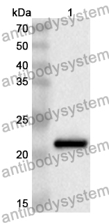 Anti-Human MRPL11 Polyclonal Antibody