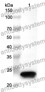 Anti-Human NABP1 Polyclonal Antibody