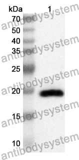 Anti-Human STMN3 Polyclonal Antibody