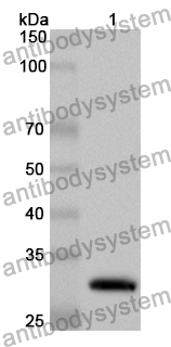 Anti-Human UCK2 Polyclonal Antibody