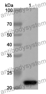 Anti-Human AEBP2 Polyclonal Antibody