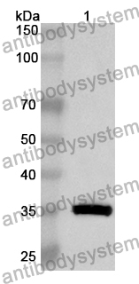 Anti-Human TBC1D23 Polyclonal Antibody