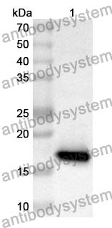 Anti-Human COX11 Polyclonal Antibody