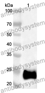 Anti-Human WDR24 Polyclonal Antibody