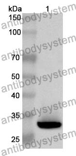 Anti-Human USP24 Polyclonal Antibody