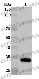 Anti-Human CNOT9 Polyclonal Antibody