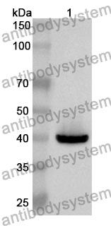 Anti-Human EXOSC3 Polyclonal Antibody