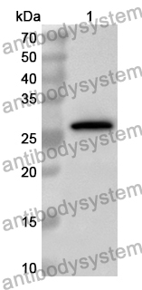 Anti-Human HORMAD1 Polyclonal Antibody