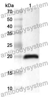 Anti-Human TRIM11 Polyclonal Antibody