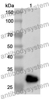 Anti-Human BBS7 Polyclonal Antibody