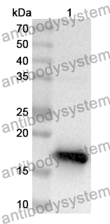 Anti-Human CMIP Polyclonal Antibody