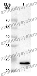 Anti-Human ARHGAP10 Polyclonal Antibody