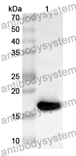 Anti-Human BHLHE41 Polyclonal Antibody