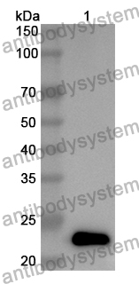 Anti-Human CTNNA3 Polyclonal Antibody