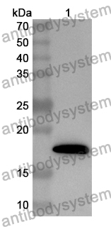 Anti-Human ING3 Polyclonal Antibody