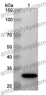 Anti-Human LHPP Polyclonal Antibody