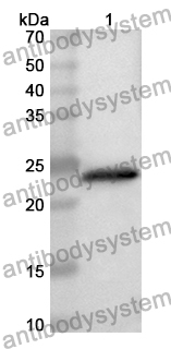 Anti-Human VTI1A Polyclonal Antibody