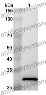 Anti-Human AFF4 Polyclonal Antibody