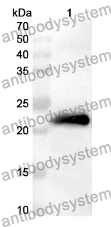 Anti-Human TIMM29 Polyclonal Antibody