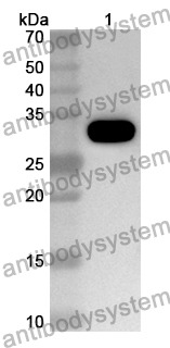 Anti-Human P2RX5 Polyclonal Antibody